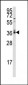 PP2A alpha Antibody (N-term)