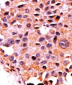 Calcineurin (PPP3CA) Antibody (N-term)