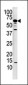 Calcineurin (PPP3CA) Antibody (N-term)