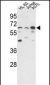 PPP3CC Antibody (N-term)