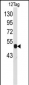 VSV-g Tag Antibody