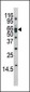 Phospho-BACE(S498) Antibody