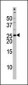 Phospho-Bad(S118) Antibody