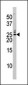 Phospho-Bad(S75) Antibody