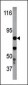 Phospho-IKKb(Y199) Antibody