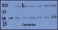 DSCR1 Antibody (C-term)