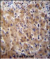 Glypican 3 (GPC3) Antibody (N-term)