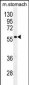 Glypican 3 (GPC3) Antibody (N-term)