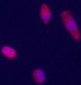 Glypican 3 (GPC3) Antibody (Center)