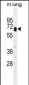 Glypican 3 (GPC3) Antibody (C-term)