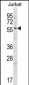 Glypican 3 (GPC3) Antibody (C-term)