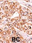 PIP5K3 Antibody (Center)