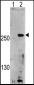 PIP5K3 Antibody (Center)