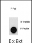 Phospho-p53(S315) Antibody