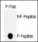 Phospho-p53(T18) Antibody