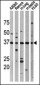 Phospho-p53(T18) Antibody