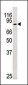 Phospho-Rb(S249) Antibody