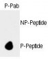 Phospho-Rb(S788) Antibody
