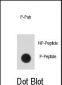 Phospho-STAT5a(S726) Antibody