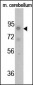 Phospho-FGFR(Y766) Antibody