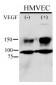 Phospho-KDR/FLK1(Y996) Antibody