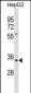 Kallikrein 9 Antibody (N-term)