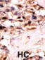 URKL1 Antibody (N-term)