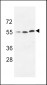 URKL1 Antibody (N-term)
