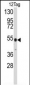 V5 Tag Antibody