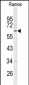 RIPK3 Antibody (N-term)