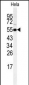 RIPK3 Antibody (Center)