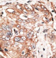 P100 Antibody