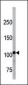 Bi-Phospho-LLGL1/2(S655/659) /(S645/S649) Antibody