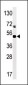 Phospho-MAPKAPK5(S93) Antibody