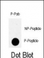 Phospho-MYT1(T495) Antibody