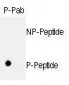 Phospho-Rb(S811) Antibody