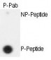Phospho-SEPARIN(S1126) Antibody