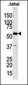 Glycerol kinase (GPK2) Antibody (C-term)