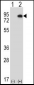 HIPK4 Antibody (C-term)