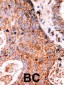 LMTK2 Antibody (N-term)
