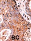 LMTK2 Antibody (N-term)
