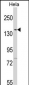 LMTK2 Antibody (N-term)