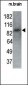 MARK1 Antibody (N-term)