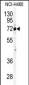 Cleavage stimulation factor 2 (CSTF2) Antibody (N-term)