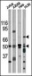 Phospho-CHK1(S317) Antibody