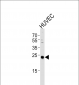 CSNK2B Antibody (C-term F168)