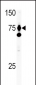 HGF Antibody (C-term)