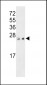 PRL3 Antibody (C-term)