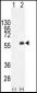 MYT1 (PKMYT1) Antibody (C-term)