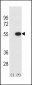 Reptin/TIP49B/RUVB2 Antibody (C-term)